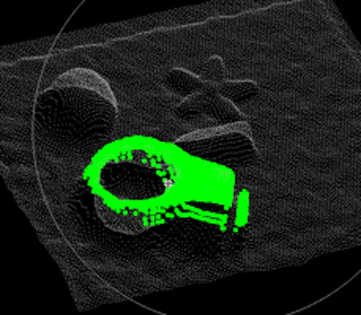 Medical CT scan with green segmentation highlighting anatomical structure
